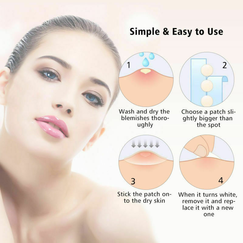 Skin Tag Acne Remover Patch-DriHer