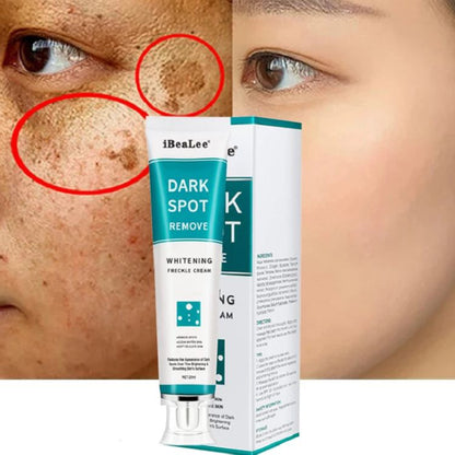 Whitening freckle cream remove dark spot-DriHer