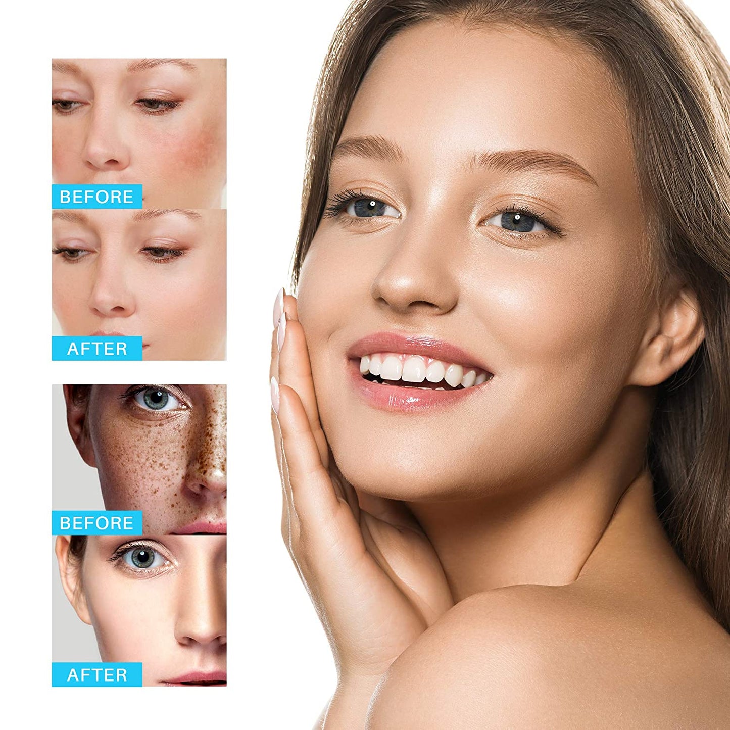 Whitening freckle cream remove dark spot-DriHer