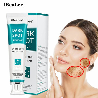 Whitening freckle cream remove dark spot-DriHer